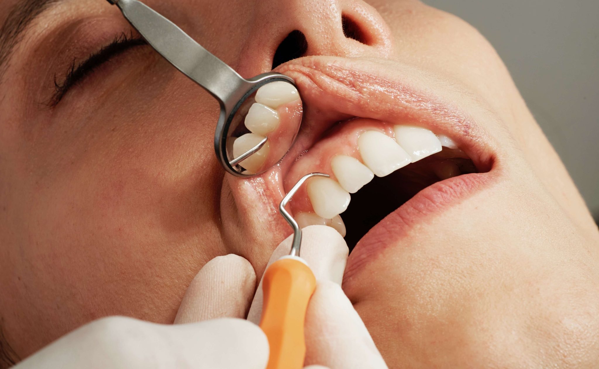 The Importance of Regular Dental Checkup